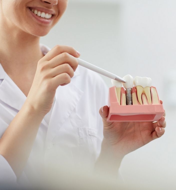 non abrasive toothpaste for dental implants